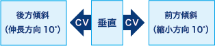 後方傾斜、前方傾斜CVが垂直